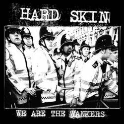 Hard Skin : We Are the Wankers EP